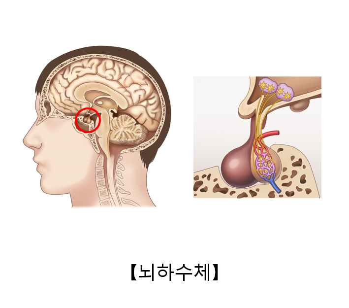 뇌하수체 기능부전