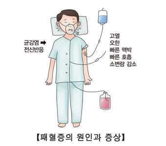 패혈증